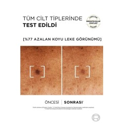Loreal Paris Bright Reveal Niasinemid ( Koyu Leke Karşıtı Serum ) 30 ml