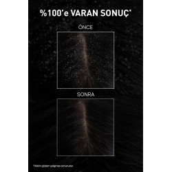 Bioxcin Aqua Thermal Kepek Karşı Etkili Şampuan Seti 200 ml + 300 ml