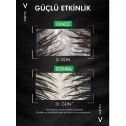 Vichy Dercos Kepek Karşıtı Şampuan Kuru Saçlar 390 ml